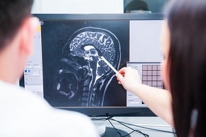 Will County car accident attorney brain injury